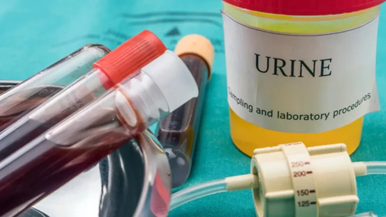 DIY Synthetic Urine Kits: Are They Effective?